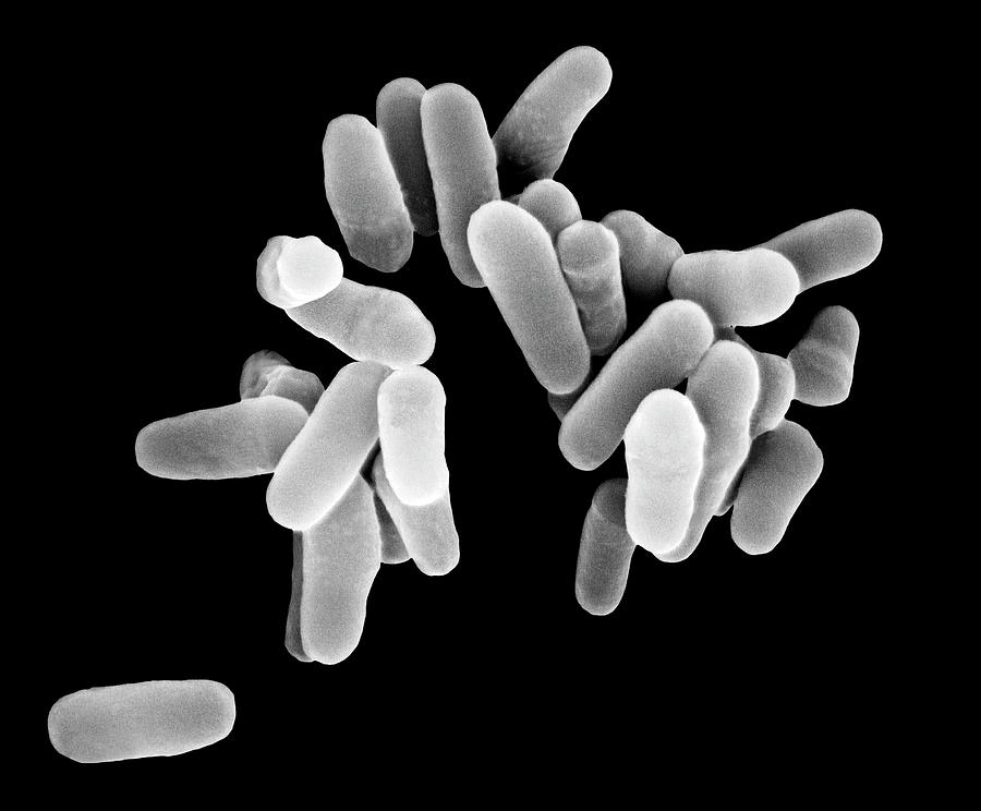 Black And White Photograph - Mycobacterium Tuberculosis #2 by Dennis Kunkel Microscopy/science Photo Library