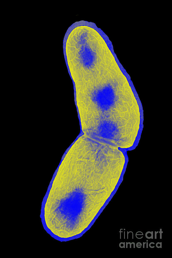 Transmission Electron Microscope Photograph - Mycobacterium Tuberculosis #2 by Kwangshin Kim