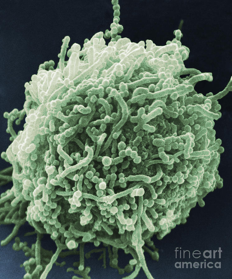 Bacterial Photograph - Mycoplasma Bacteria, Sem #2 by David M. Phillips