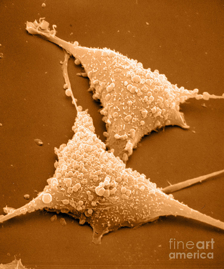 Mycoplasma #2 Photograph by David M. Phillips