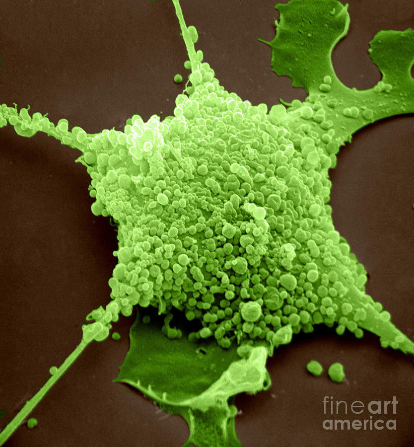 Mycoplasma, Sem #2 Photograph by David M. Phillips