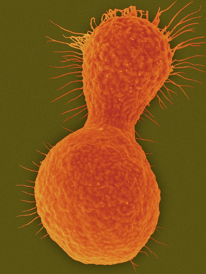 Myxozyma Mucilagina Ascomycetous Yeast #2 Photograph by Dennis Kunkel Microscopy/science Photo Library