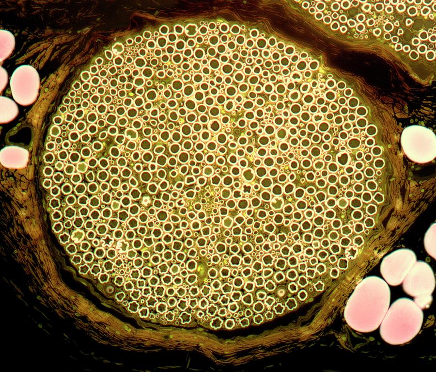 Nerve Bundle #2 by Steve Gschmeissner/science Photo Library