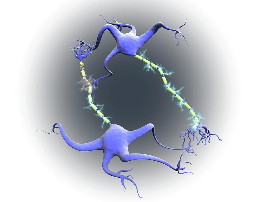 Nerve Cells In Multiple Sclerosis Photograph By Gunilla Elamscience Photo Library