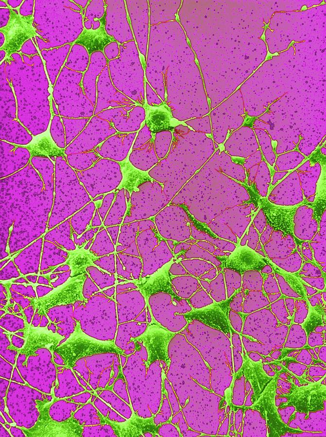 Nerve Cells #2 Photograph by Steve Gschmeissner