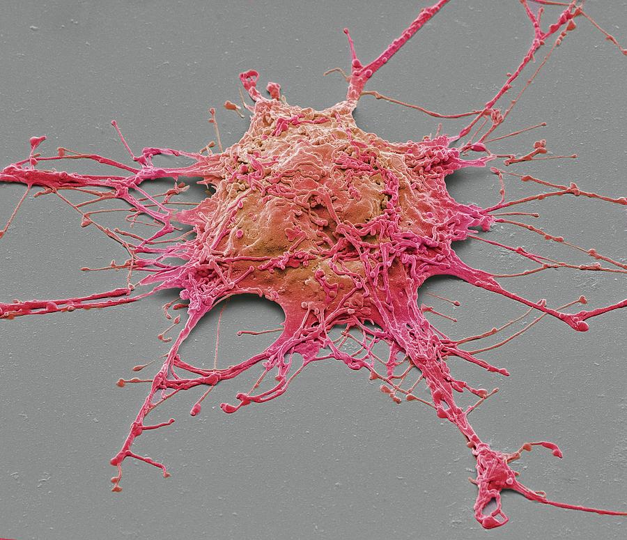Neurone #2 Photograph by Steve Gschmeissner
