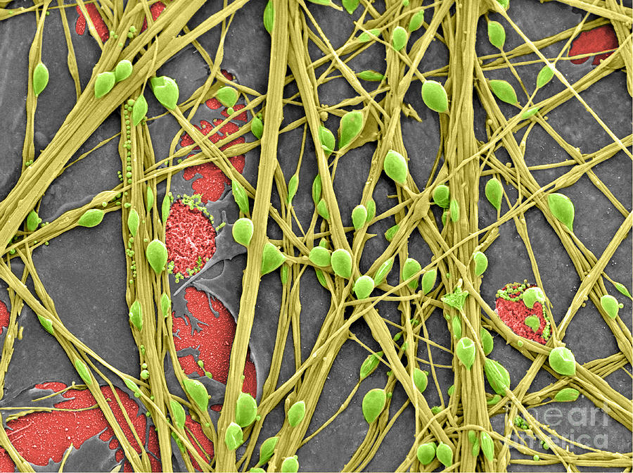 Neurons And Glial Cells, Sem #2 Photograph by Science Source