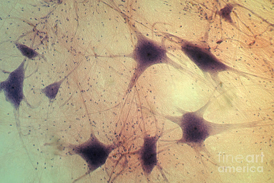 Neurons #2 Photograph by David M. Phillips
