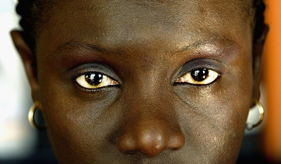 New Measures To Prohibit Female Circumcision Announced In London Photograph by Graeme Robertson New Measures To Prohibit Female Circumcision Announced In London Photograph by Graeme Robertson