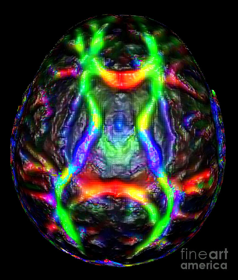Normal Brain Diffusion Tractography #2 Photograph by Living Art Enterprises