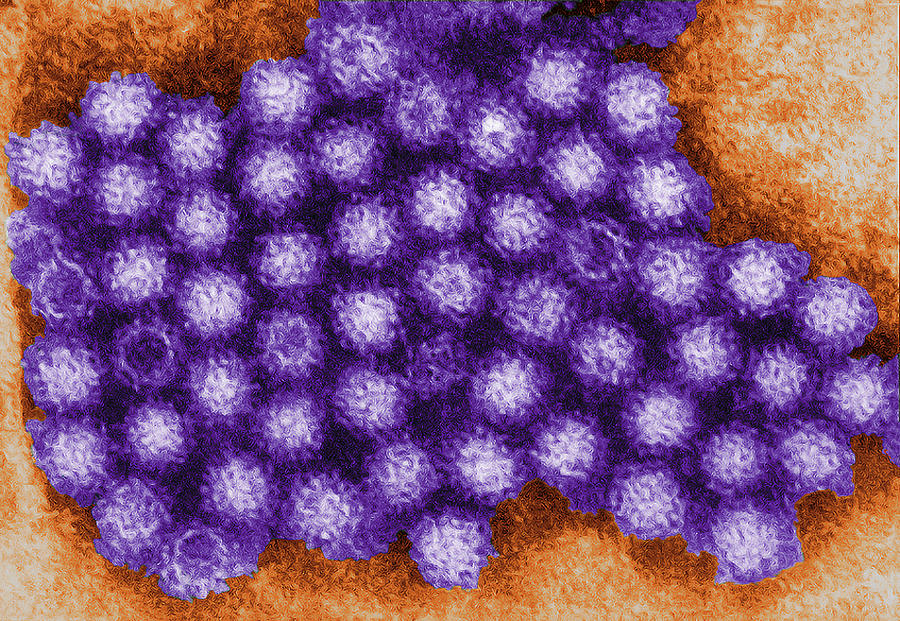 Norovirus, Tem #2 Photograph by Science Source