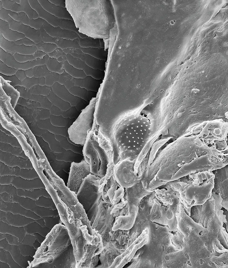 Nose Hair With Mucus And Trapped Pollen Grain #2 Photograph by Dennis Kunkel Microscopy/science Photo Library