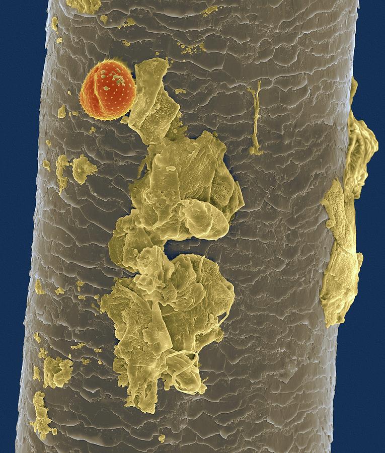 Nose Hair With Pollen Grain #2 Photograph by Dennis Kunkel Microscopy/science Photo Library