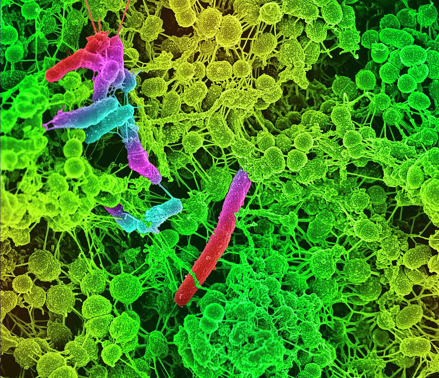 Oral Bacteria #2 Photograph by Science Photo Library
