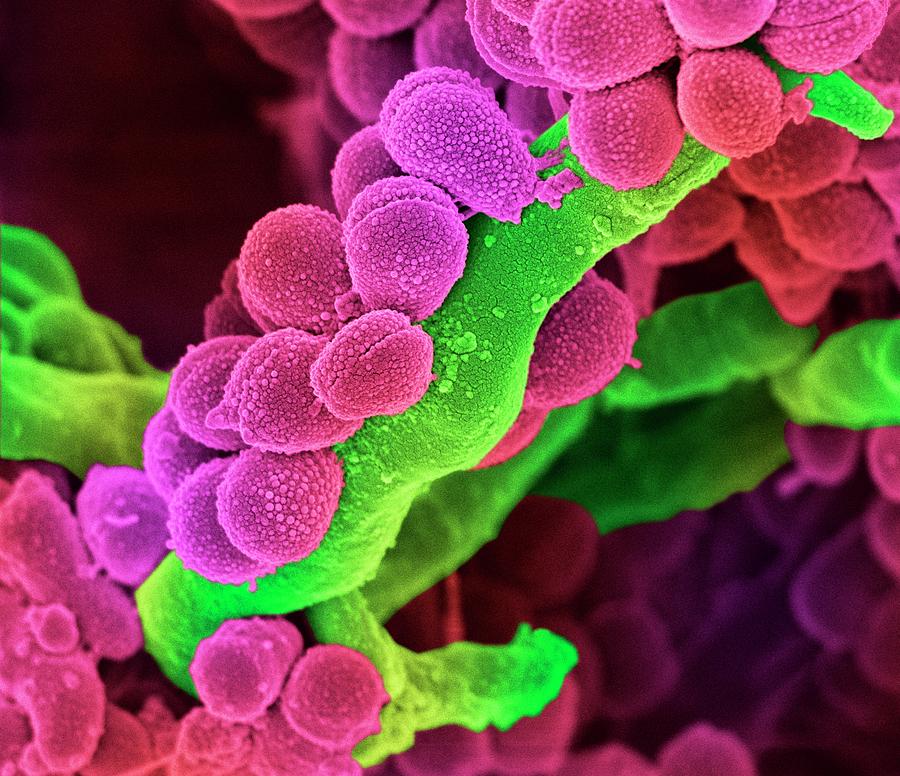Streptococcus Photograph - Oral Streptococcus Bacteria #2 by Science Photo Library