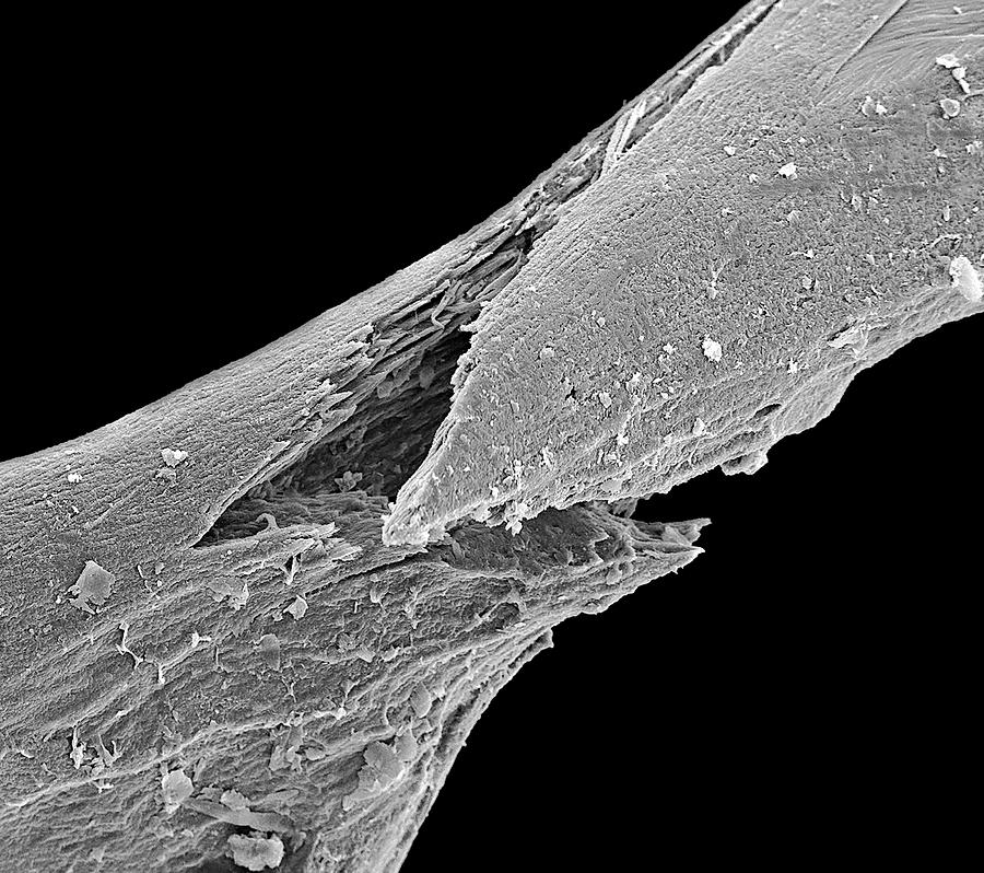 Osteoporotic Bone #2 Photograph by Steve Gschmeissner/science Photo Library