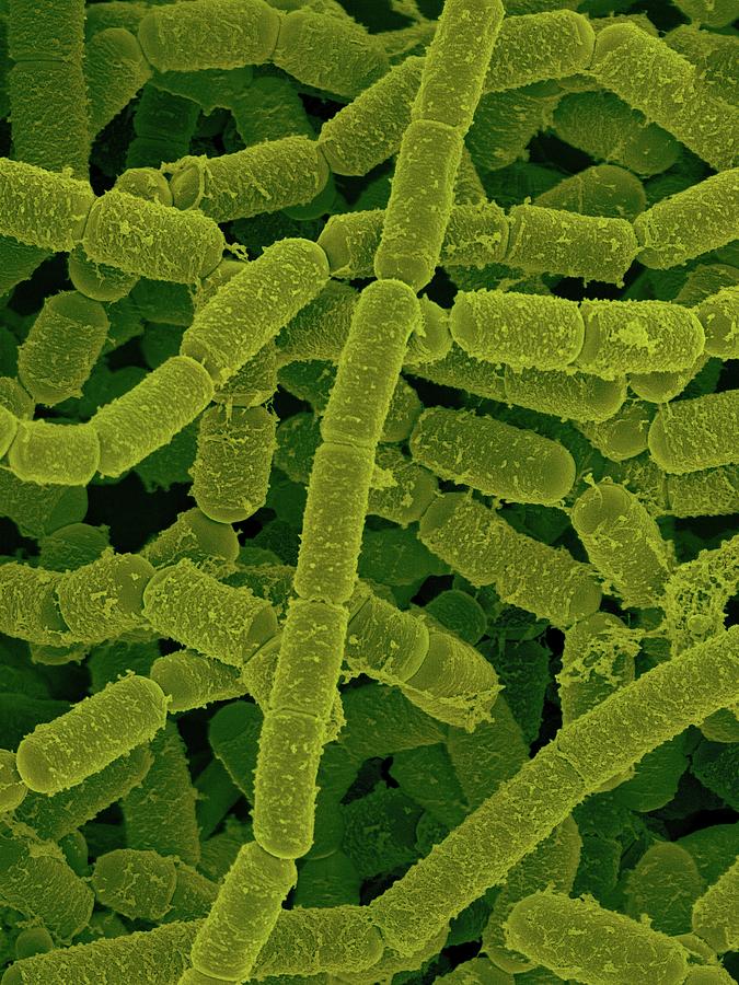 Paenibacillus Amylolyticus #2 Photograph by Dennis Kunkel Microscopy/science Photo Library
