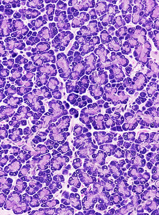 Pancreas #2 Photograph by Microscape