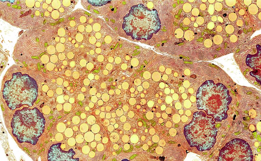 Pancreatic Secretory Cells #2 Photograph by Medimage/science Photo Library
