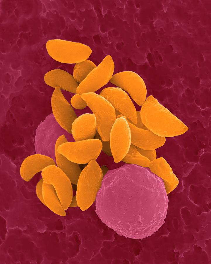 Parasitic Protozoan Tachyzoites #2 Photograph by Dennis Kunkel Microscopy/science Photo Library