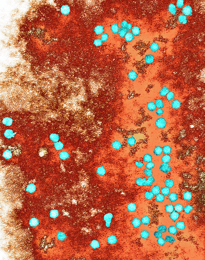 Pea Enation Mosaic Virus Photograph by Centre For Bioimaging ...