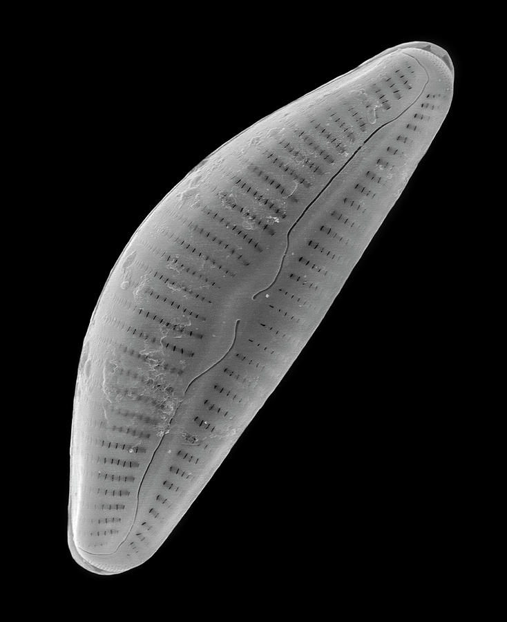 Pennate Marine Diatom (cymbella Sp.) Photograph By Dennis Kunkel ...