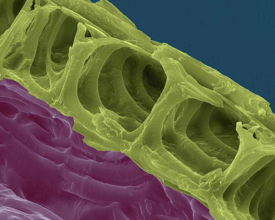 The Structure Of Cellulose Is Related To Its Role In Plant Cell Walls ...