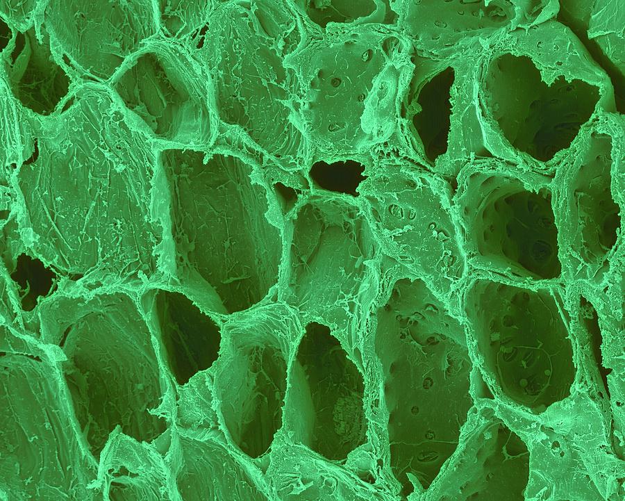 What Is Cellulose In The Cell Wall Of A Plant Cell