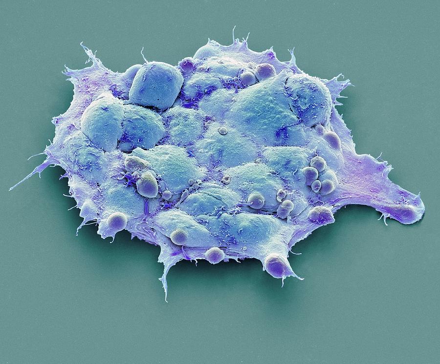 Pluripotent Stem Cells #2 Photograph by Steve Gschmeissner