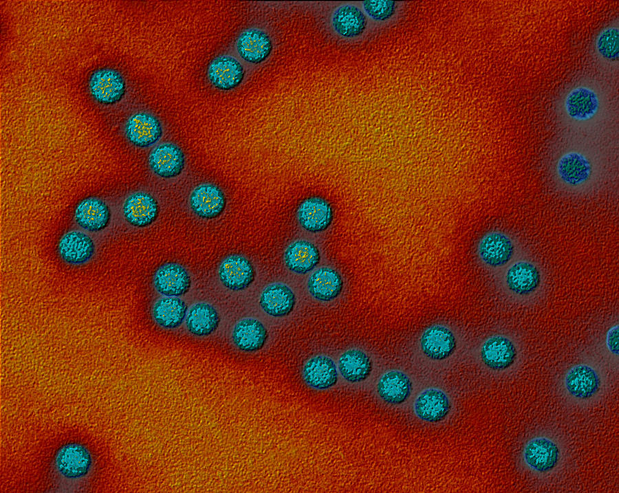 Polio Viruses #2 Photograph by Eye of Science
