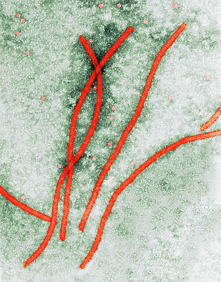 Potato Y Virus Photograph by Centre For Bioimaging, Rothamsted Research
