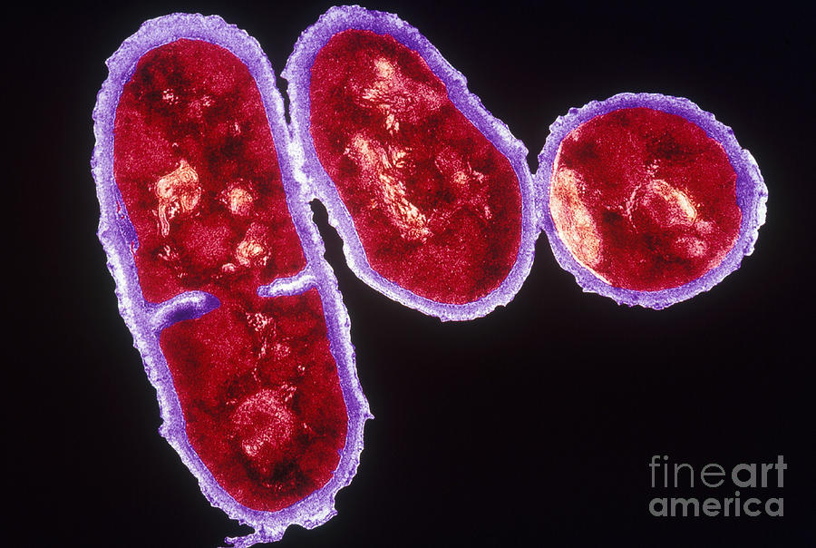 Propionibacterium Acnes, Tem #2 Photograph by Kwangshin Kim
