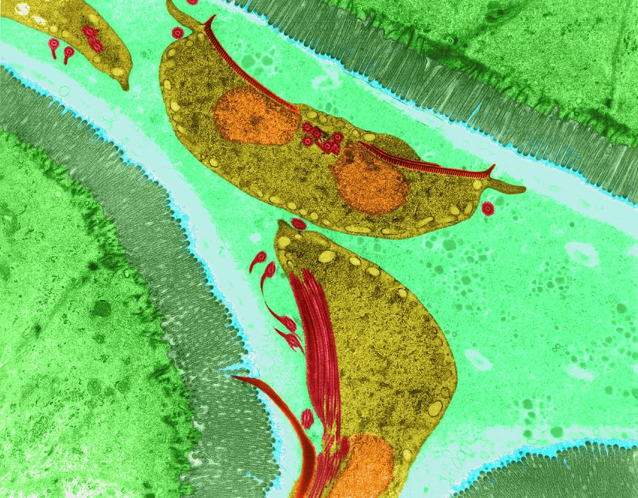 Protozoan Intestine Infection (giardia Sp.) #2 Photograph by Dennis Kunkel Microscopy/science Photo Library