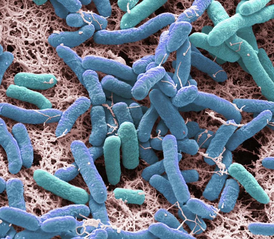 Pseudomonas Bacteria #2 Photograph By Science Photo Library - Pixels