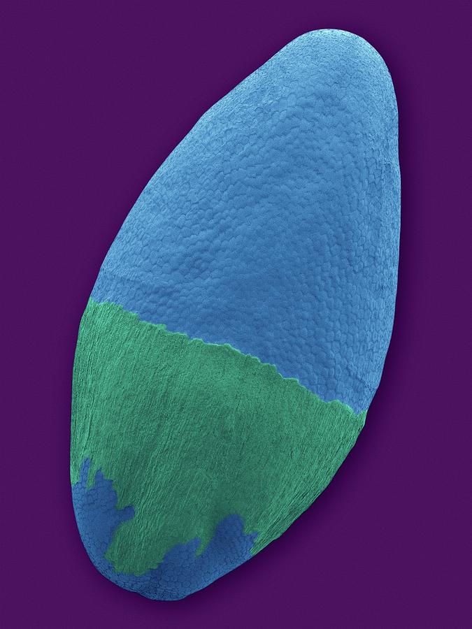 Psyllium Seed (plantago Ovata) #2 Photograph by Dennis Kunkel Microscopy/science Photo Library