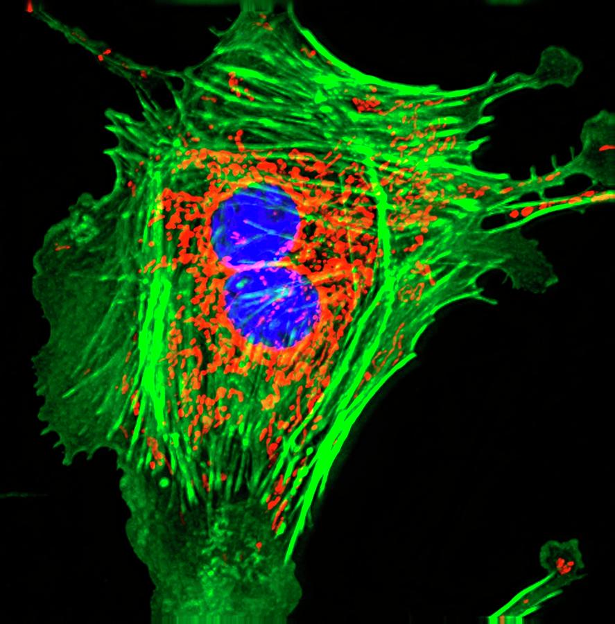 Pulmonary Artery Cells #2 Photograph by R. Bick, B. Poindexter, Ut Medical School/science Photo Library