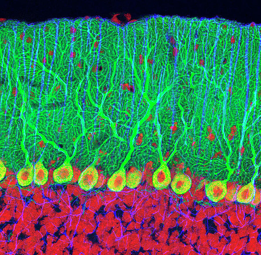 Purkinje Cell Photograph - Purkinje Nerve Cells In The Cerebellum #2 by Thomas Deerinck, Ncmir