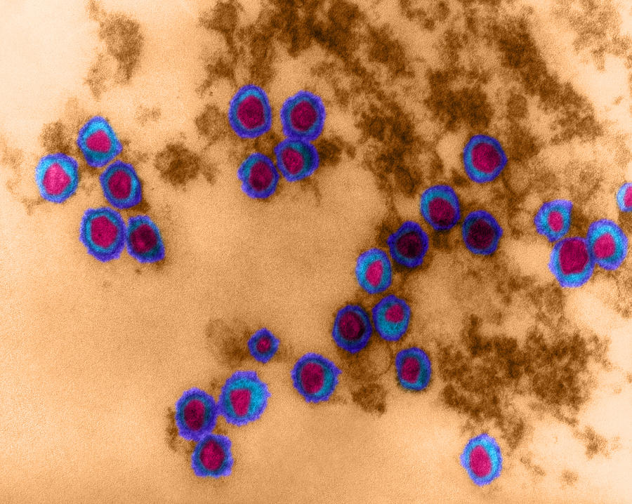 Science Photograph - Rauscher Leukemia Virus, Tem #2 by Omikron