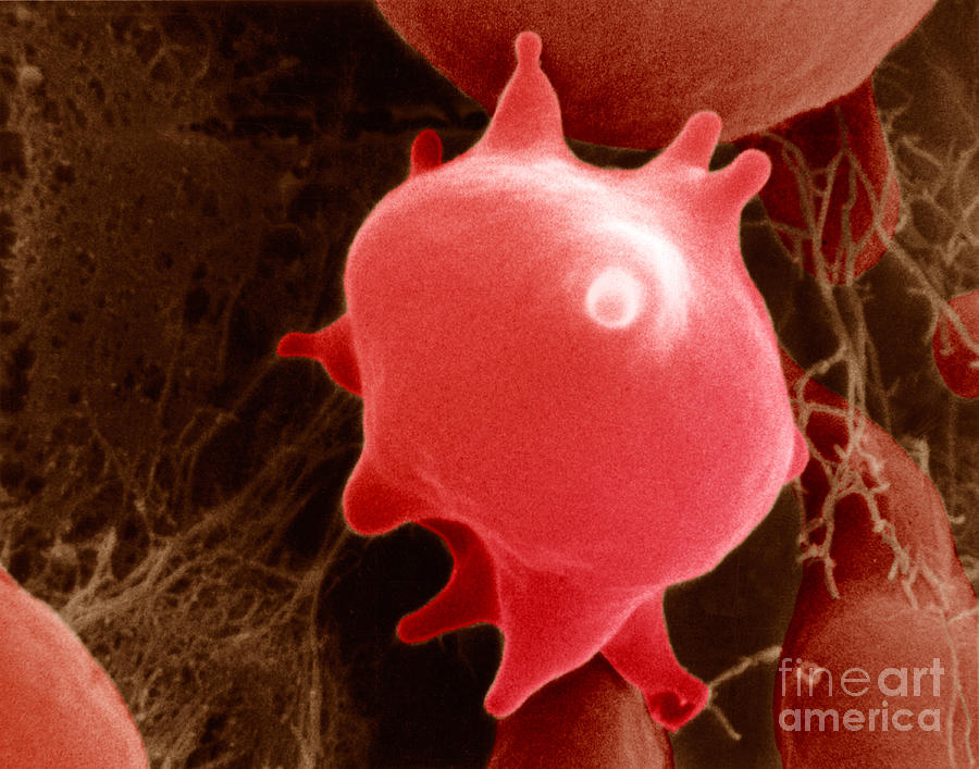Red Blood Cell In Hypertonic Solution #2 Photograph by David M. Phillips