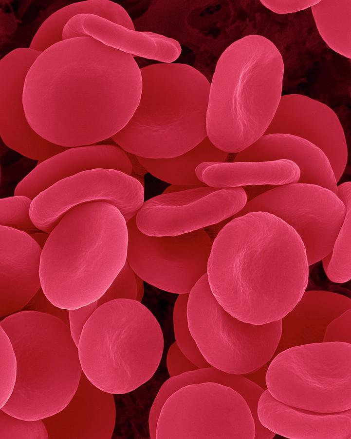 Red Blood Cells In Isotonic Solution #2 Photograph by Dennis Kunkel Microscopy/science Photo Library