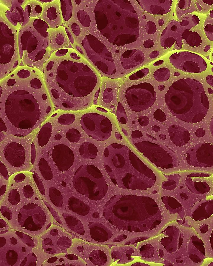 Reticulite Lava Photograph by Dennis Kunkel Microscopy/science Photo ...