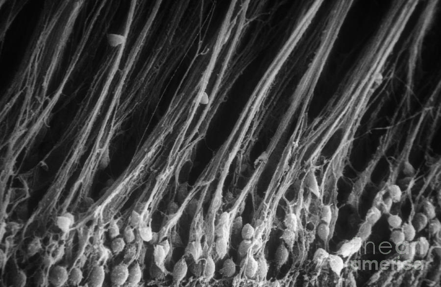 Retinal Axons, Sem #2 Photograph by Ralph C. Eagle, Jr.