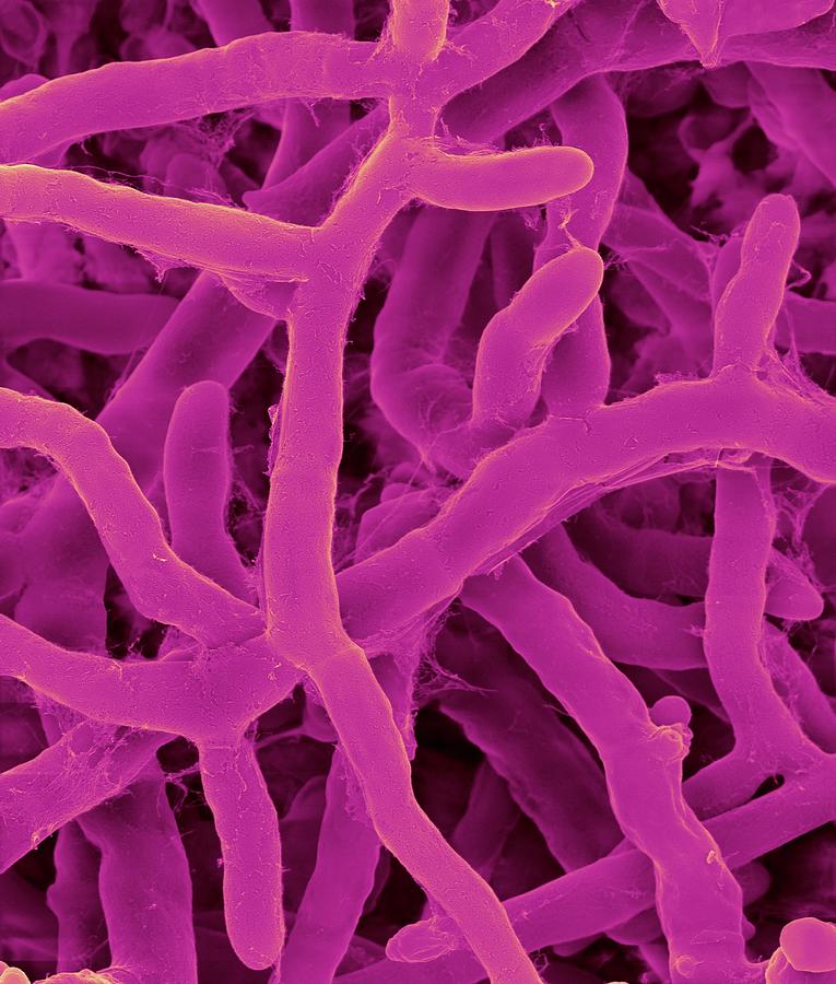Rhizoctonia Solani Pathogenic Plant Fungus #2 Photograph by Dennis Kunkel Microscopy/science Photo Library