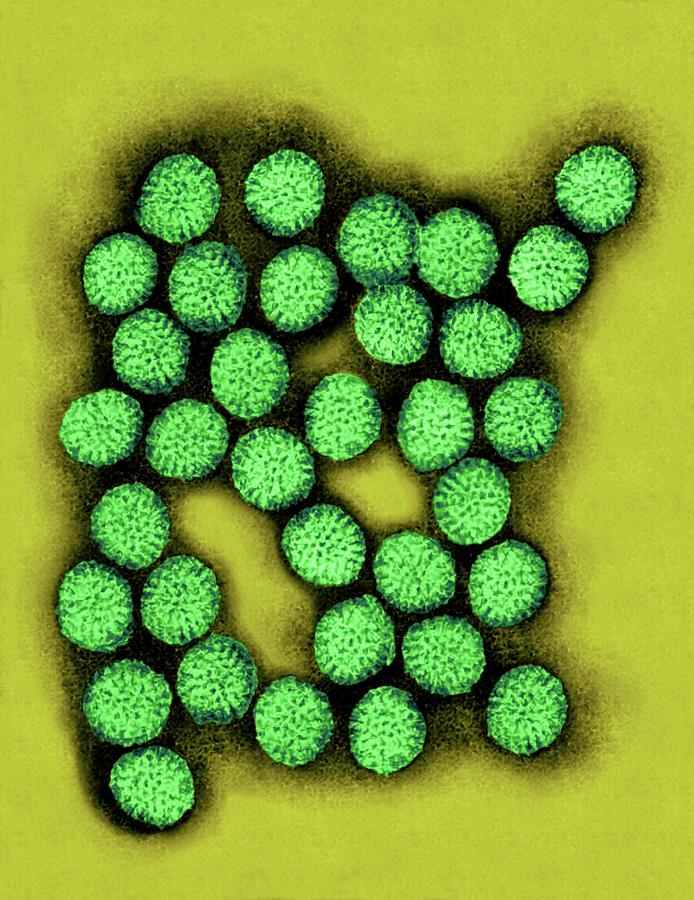 Rotavirus Photograph by Dennis Kunkel Microscopy/science Photo Library