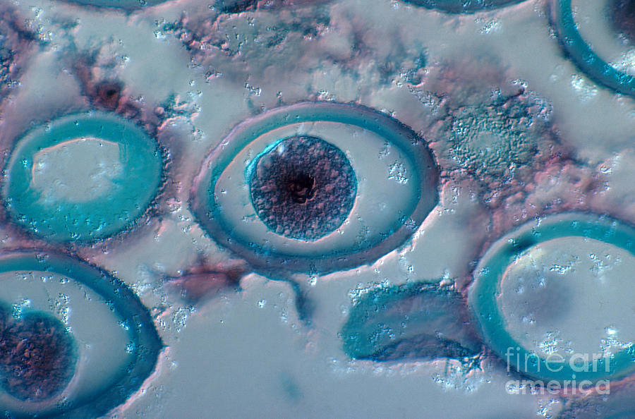 Roundworm Cells In Metaphase, Lm #2 Photograph by Joseph F. Gennaro Jr.