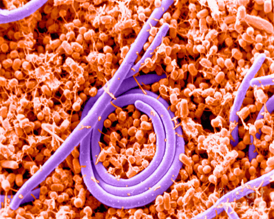 Salmonella Enteritidis, Sem #3 Photograph by Science Source