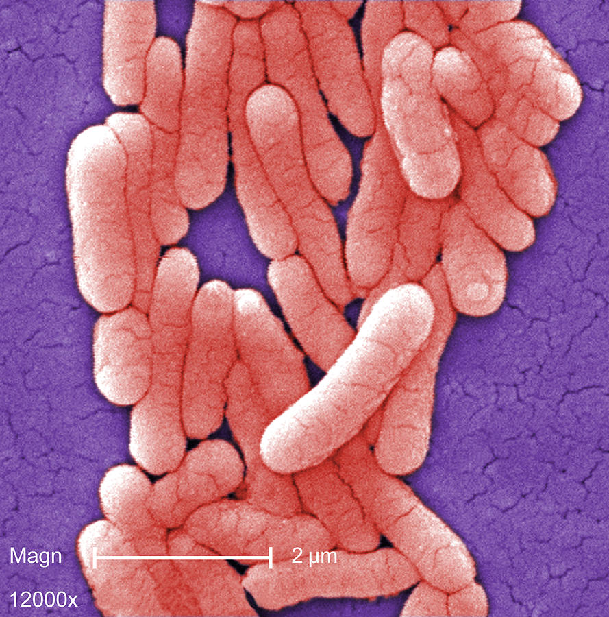 Salmonella Typhimurium Bacteria, Sem #2 Photograph by Science Source