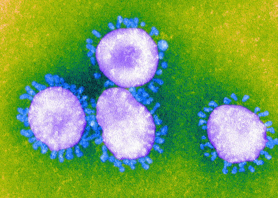 Sars Coronavirus, Em #2 Photograph by Science Source