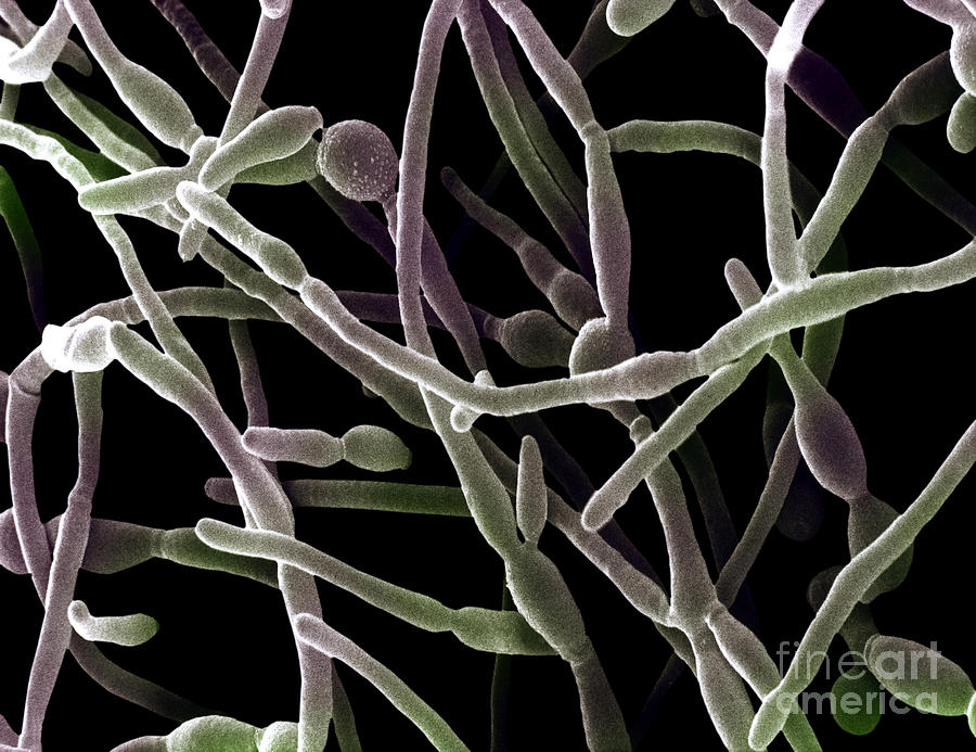 Scanning Electron Micrograph Of Candida #2 Photograph by David M. Phillips