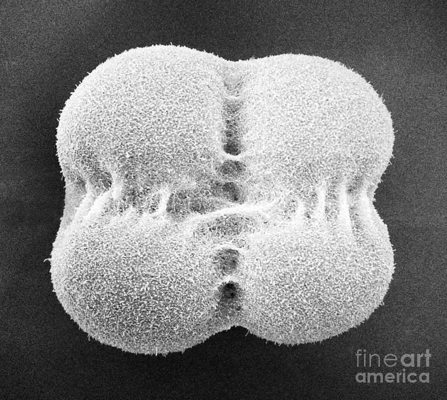 Sea Urchin Embryo Photograph By David M Phillips